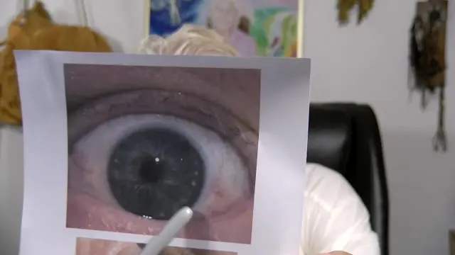 Kadr z nagrania: Q&A dr. Morse'a: Schizofrenia, Skurcze mięśni, Guz z komórek rozrodczych, Dystrofia mięśniowa (zanik mięśni), Duchowość